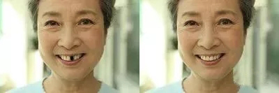 没有20颗牙，难活到80岁？听听全国政协委员怎么说！